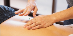 Acupuncture in persons with an increased stress level